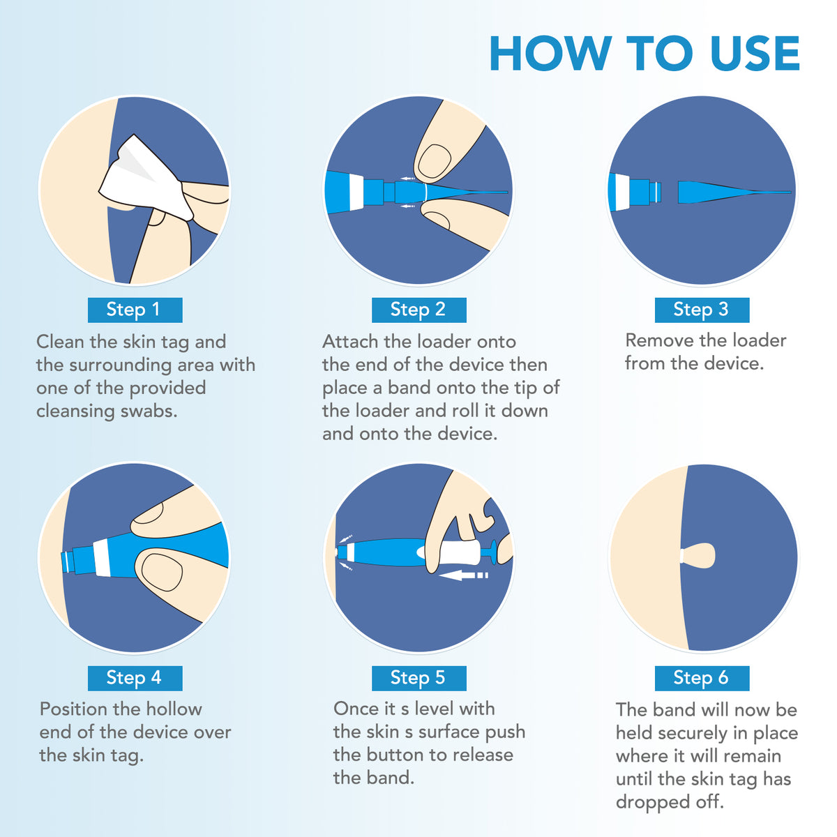 DermaEase™ Precision Skin Tag Remover – Clinically Inspired